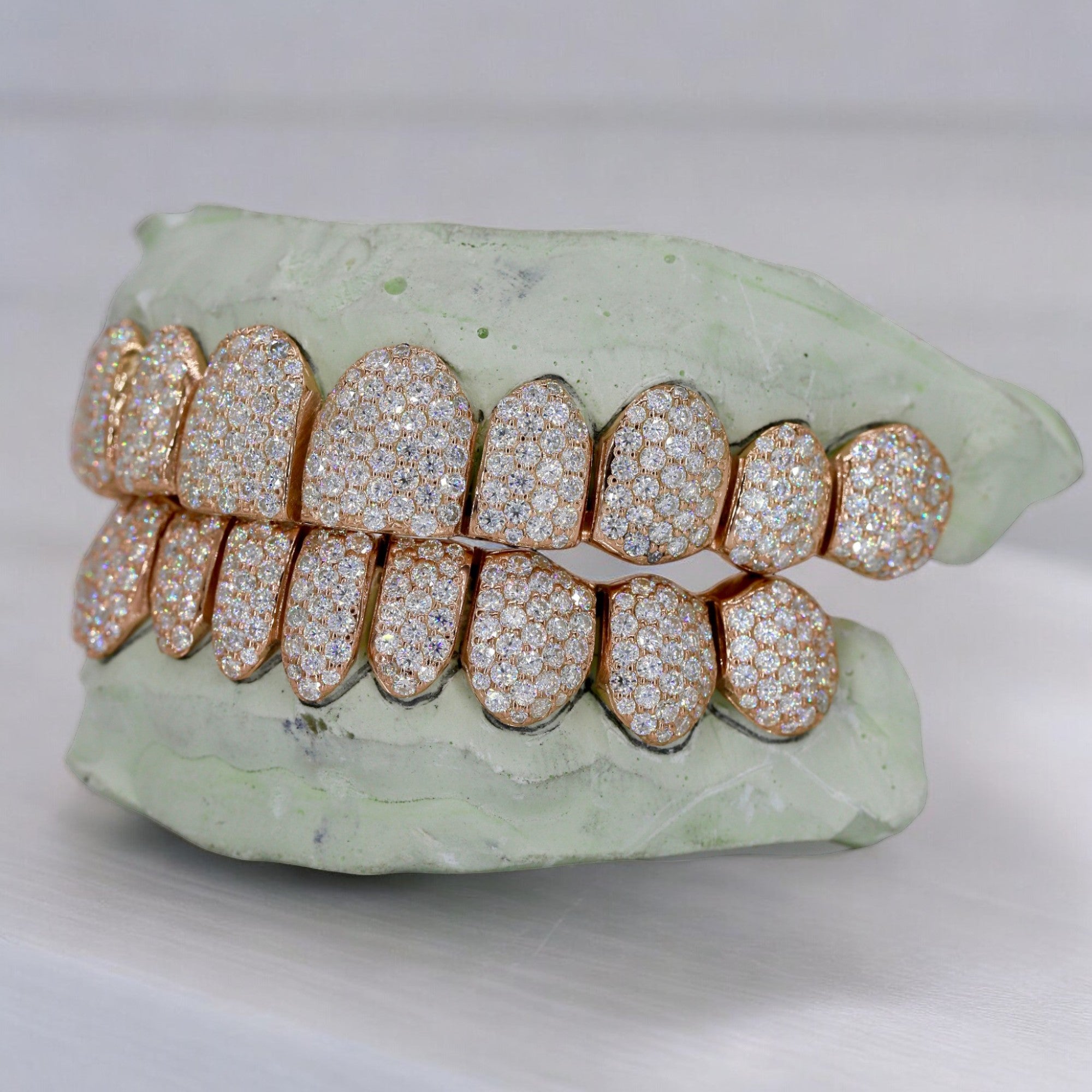 10 ON 10 VVS Moissanite Diamond Grillz