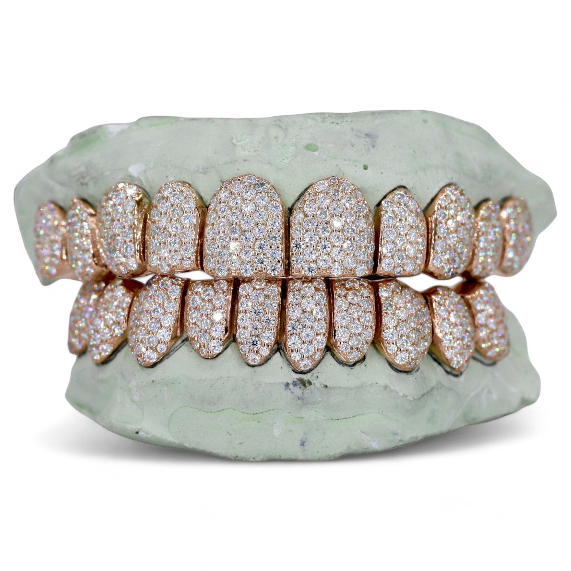 10 ON 10 VVS Moissanite Diamond Grillz