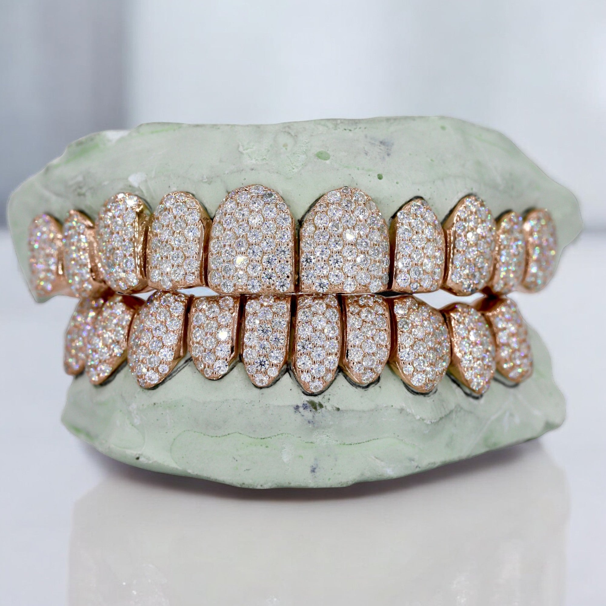 10 ON 10 VVS Moissanite Diamond Grillz