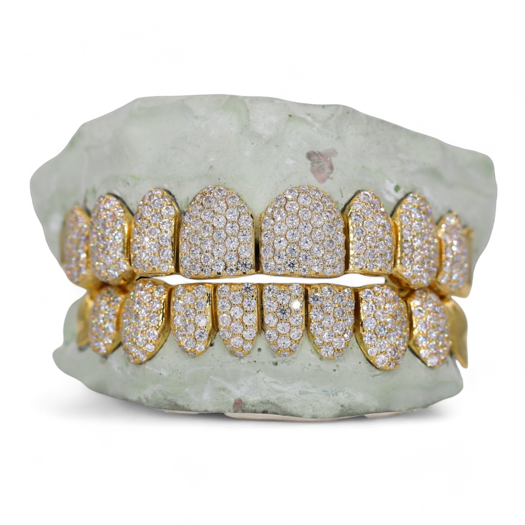 10 ON 10 VVS Moissanite Diamond Grillz