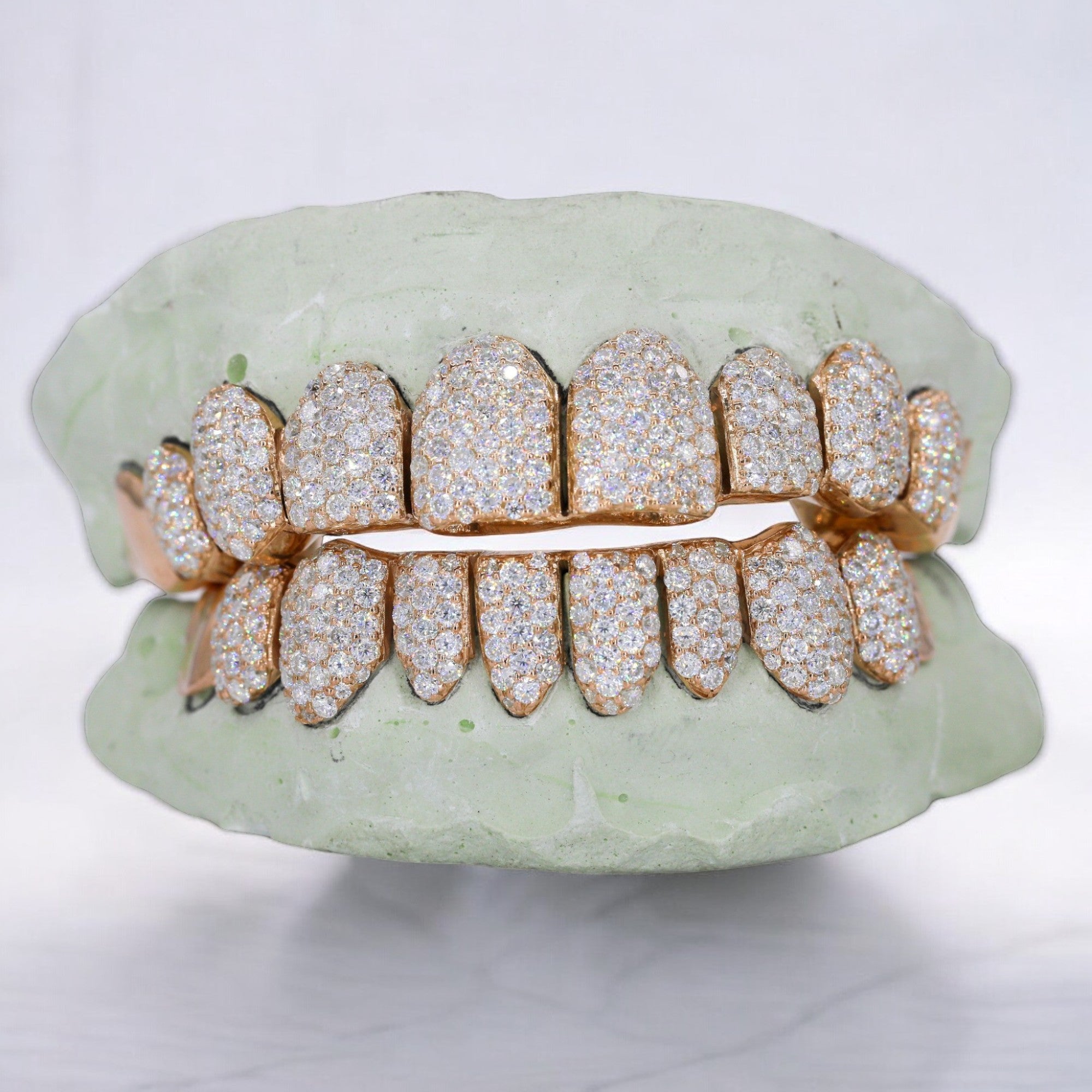 10 ON 10 VVS Moissanite Diamond Grillz