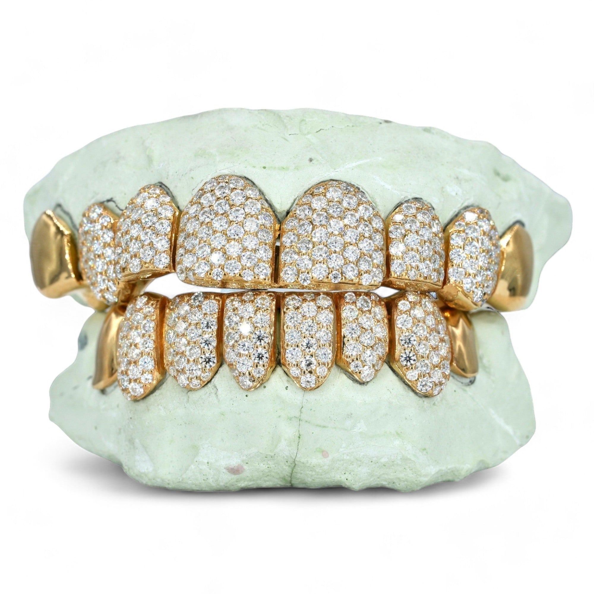 8 ON 8 VVS Moissanite Diamond Grillz